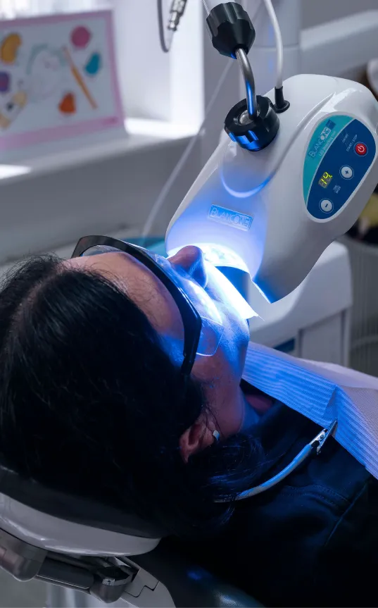 In-office teeth whitening in Prague